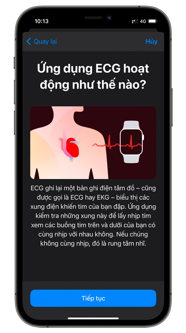 Cách đo điện tâm đồ ECG bằng Apple Watch tại Việt Nam 5